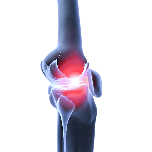 The Prevalence of Osteoarthritis | RegenCen